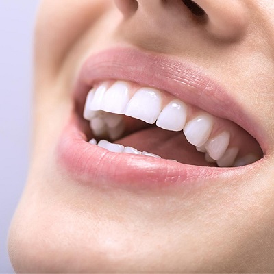 Best Teeth Whitening Methods: Achieve a Brighter Smile