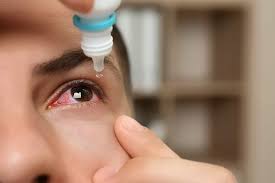 eye drops