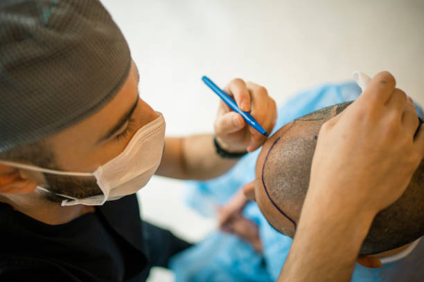 Comprehensive Guide to Hair Transplant Pricing