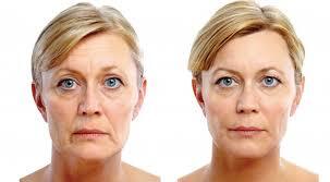 Dermal Fillers Restore Lost Volume