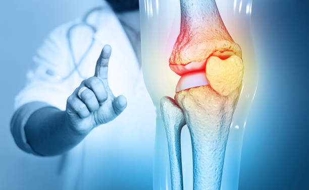 Comprehensive Osteoarthritis Therapies: Effective OA Treatment and Therapy Options