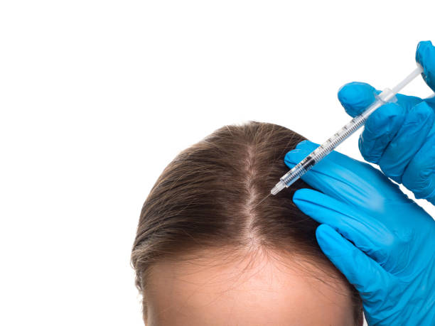 PRP Hair Treatment in Islamabad: A Comprehensive Guide