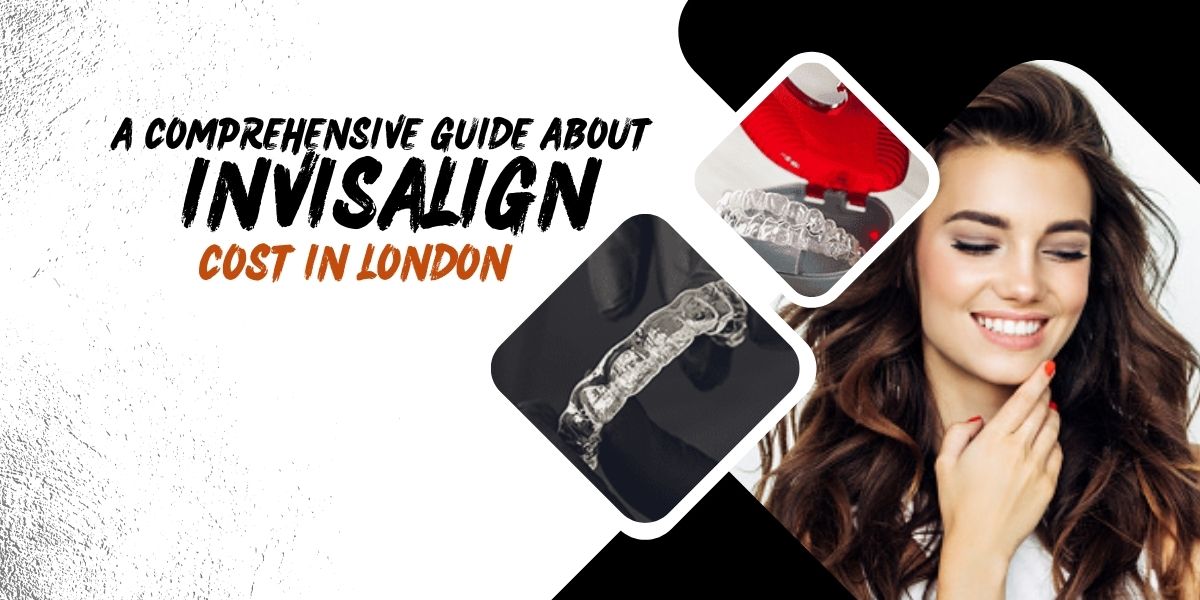 A Comprehensive Guide about Invisalign Cost in London