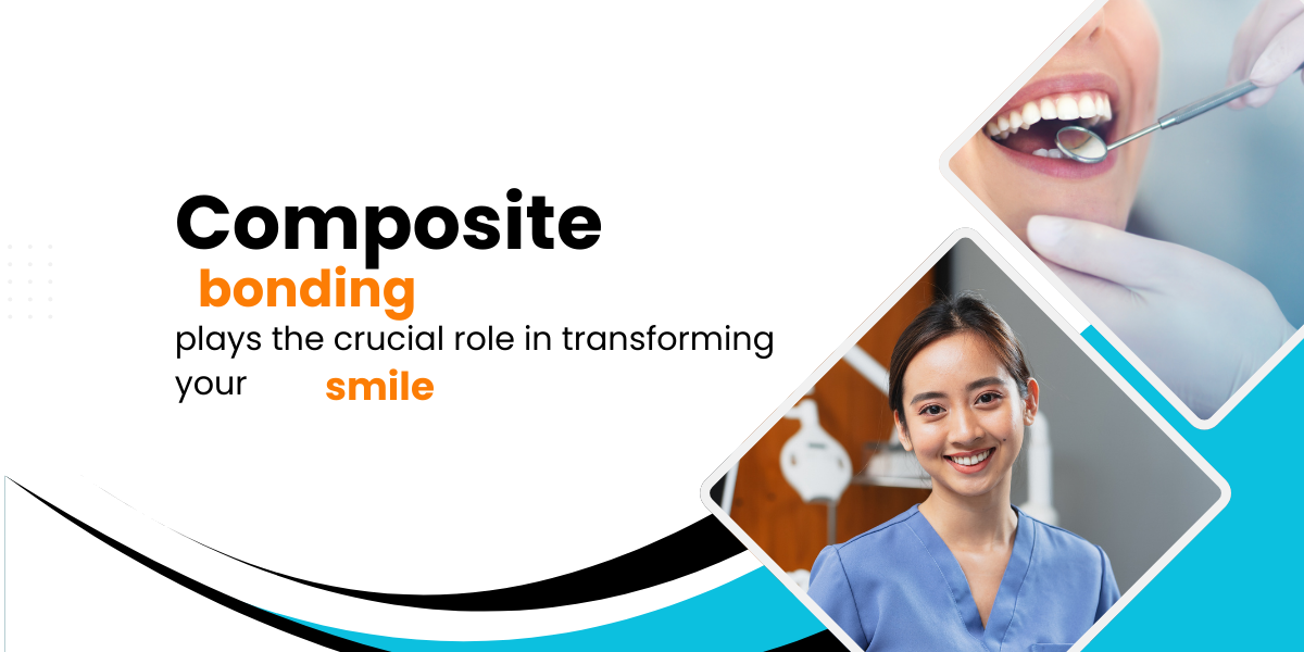 Composite bonding plays the crucial role in transforming your smile