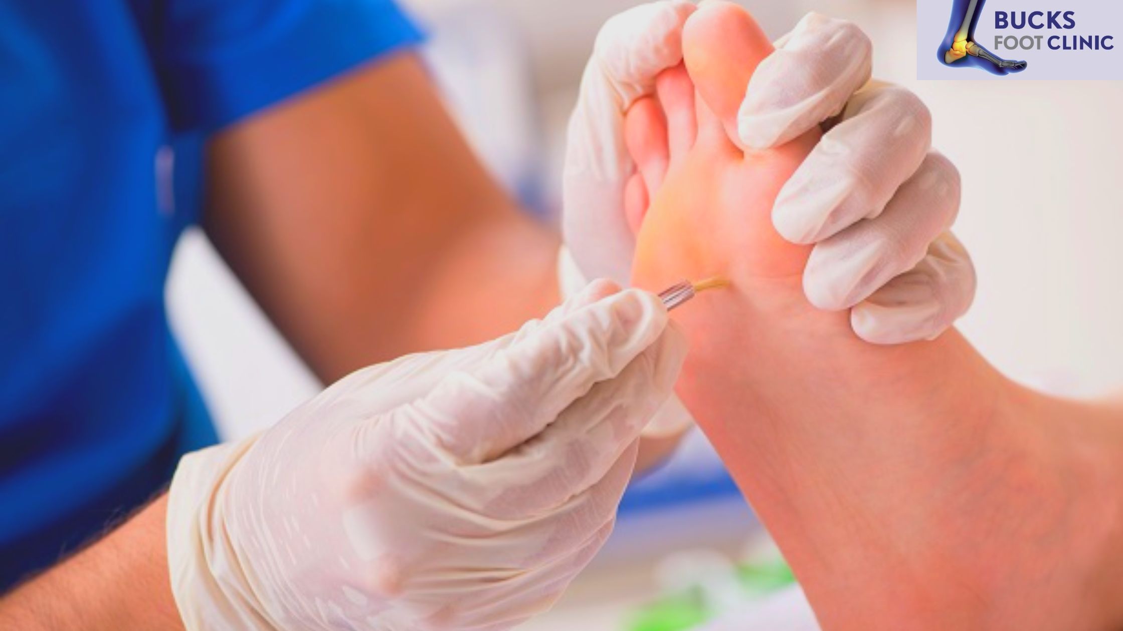 Edinburgh's Footcare for Foot Pain, Corns, and Calluses